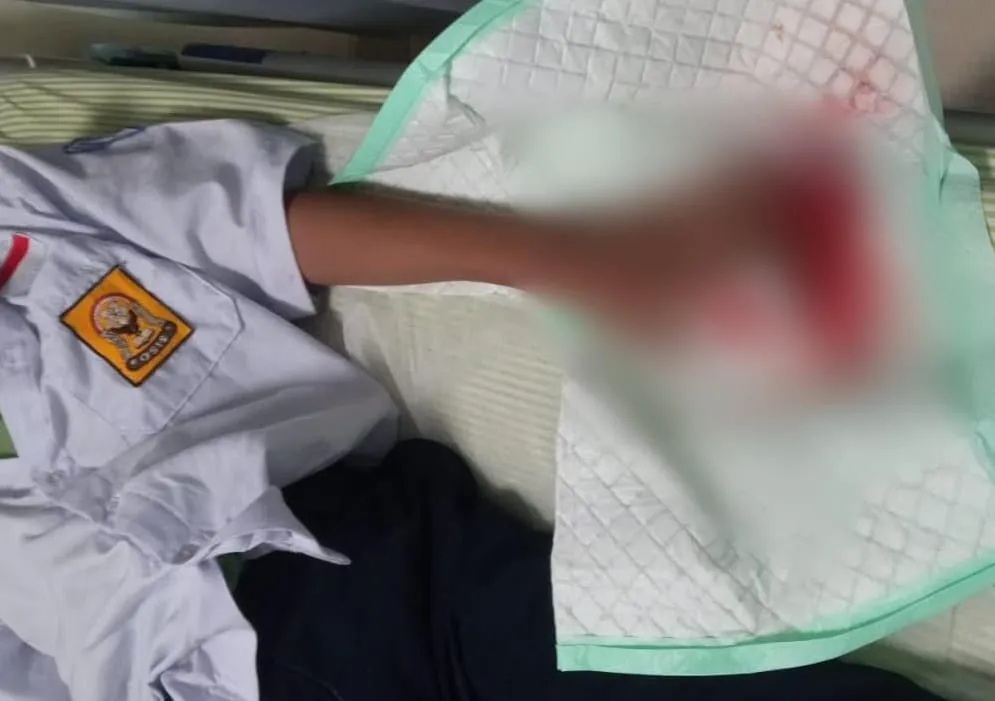 Keluarga Siswa MTs Korban Perundungan di Pati Ungkap Kronologi, Minta Kasus Diproses Hukum